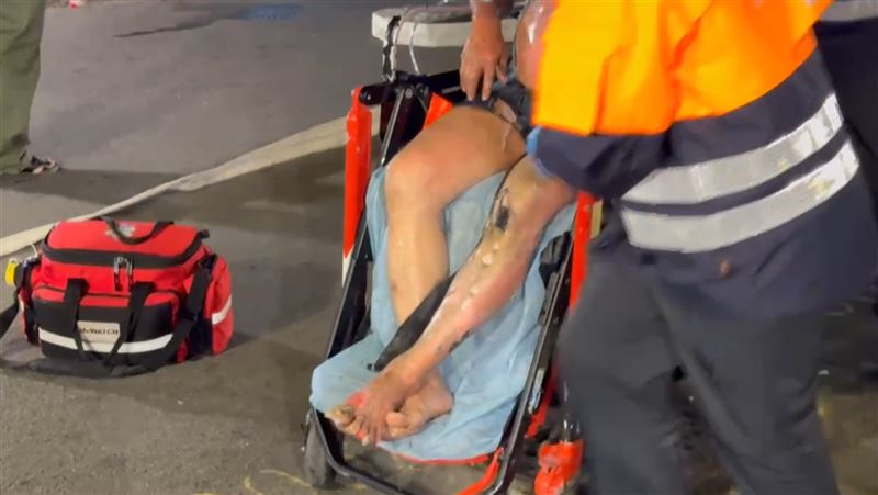 60歲男子被救出時全身多處燒燙傷。（圖／翻攝畫面）