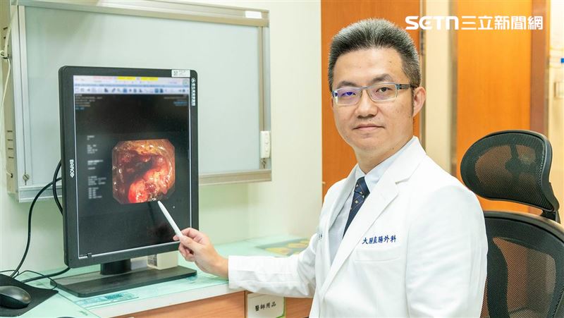 1天蹲馬桶12小時!腫瘤塞大腸害嚴重便秘