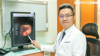 大腸癌,便祕,腸道,堵塞,蹲廁所,12小時,彰基,達文西機械手臂,乙狀結腸癌（圖／彰基提供）