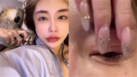 雪碧透露整形後遺症。（圖／翻攝自臉書）