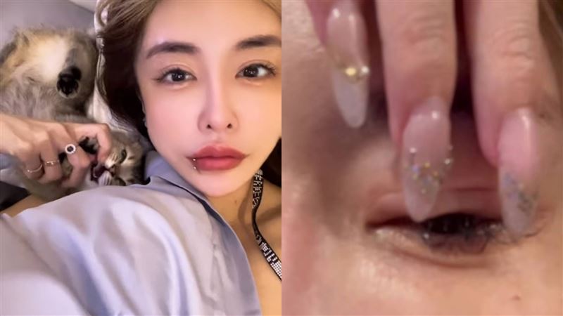 雪碧痛曝整形後遺症：像針插在眼睛裡