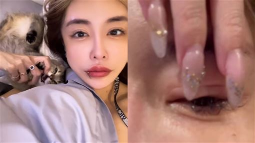 雪碧痛曝整形後遺症：像針插在眼睛裡