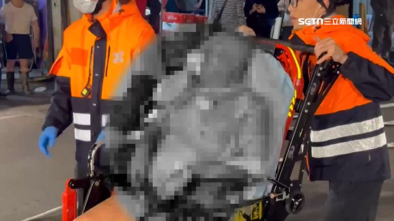 75歲老翁全身多處二度燒燙傷