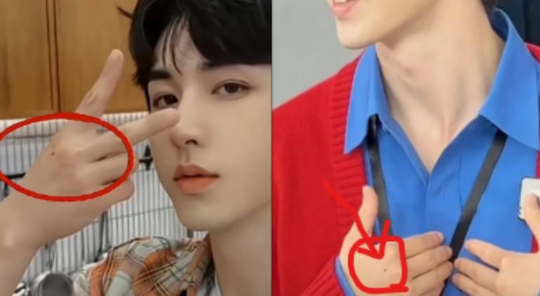 郭俊辰的右手背原本有一顆明顯的黑痣。（圖／翻攝自TikTok）