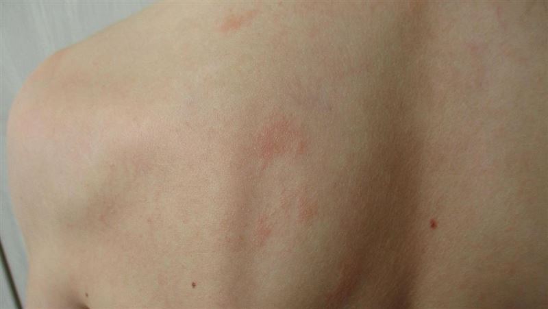 開會揭女員工有皰疹 台積電副理要賠10萬