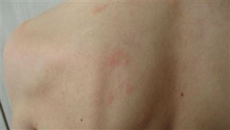 開會揭女員工有皰疹　台積電副理要賠10萬