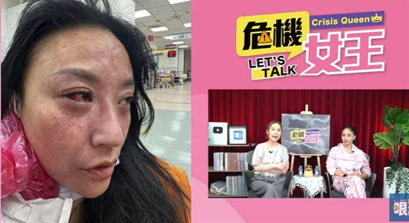 公開家暴照控尪勒脖 安歆澐發不自殺聲明