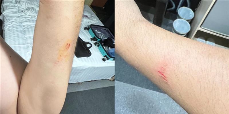 捷適商旅天花板崩落，水泥碎塊直落床頭，男子立刻用手護頭，所幸只有擦挫傷。（圖／翻攝自爆料公社二社）