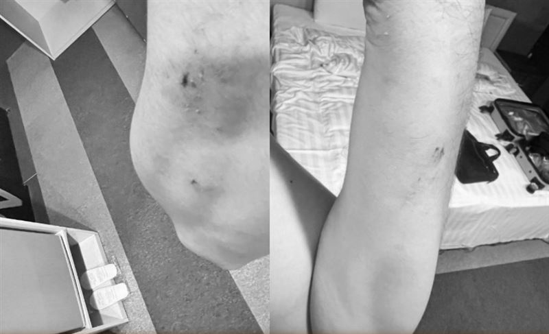 男子入住桃園中壢區某旅館，卻被崩落的天花板砸傷。（圖／翻攝爆料公社）