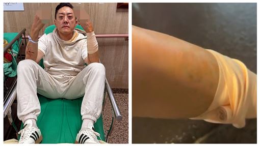 才撕名媛界大S前妻 夜店大亨遭砍濺血怒嗆