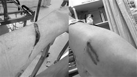 「夜店大亨」夏天倫昨傍晚與女伴遭多人襲擊，雙手受傷。（圖／翻攝自Threads @hsia_alan）