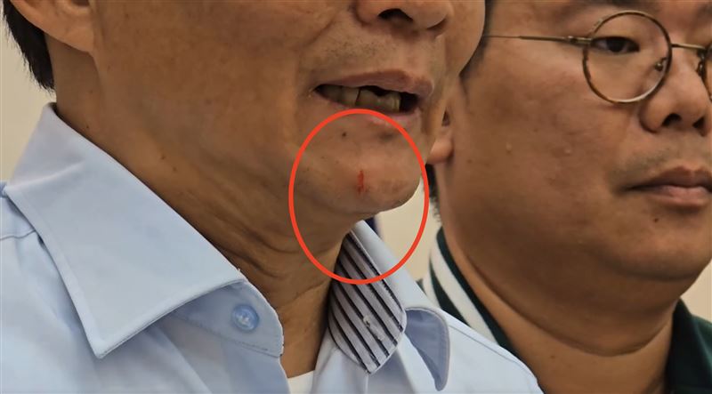 民進黨新竹市議員曾資程下巴掛彩。（圖／翻攝畫面）