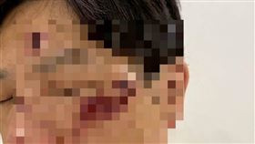 ▲PAZZO董座廖承豪曝自己臉上的傷勢和驗傷單，對於做了不良示範，至上歉意。（圖／翻攝畫面）
