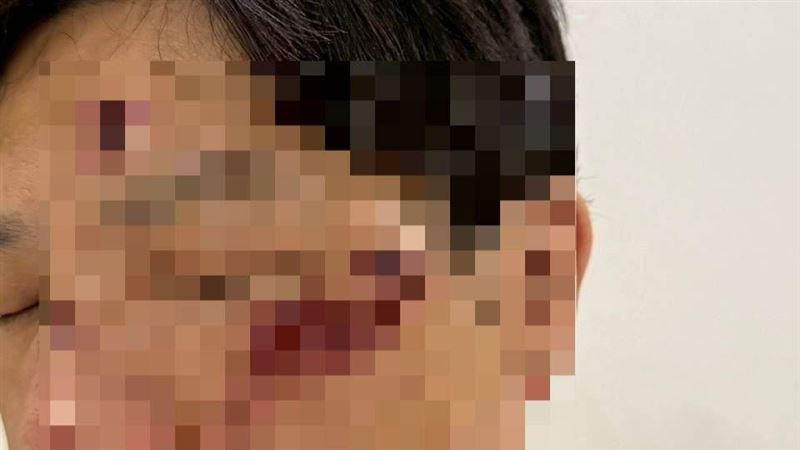 PAZZO董座被控毆打運將　發聲道歉