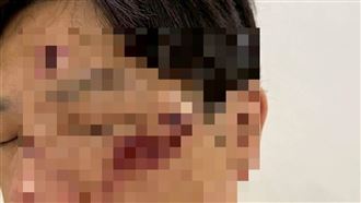 PAZZO董座被控毆打運將　發聲道歉