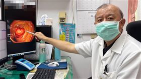 便祕一整天又血便，70多歲婦，頭暈送醫，檢查出大腸癌(圖／大甲李綜合醫院提供)