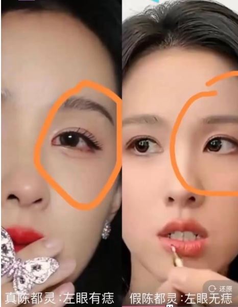網友公開陳都靈真假對比照，分析兩人左眼一個有痣，一個無痣。（圖／翻攝自網路）