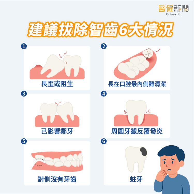 建議拔除智齒6大情況,琳揚牙科林伯叡醫師為大家一次做說明。(圖/醫健新聞網提供)
