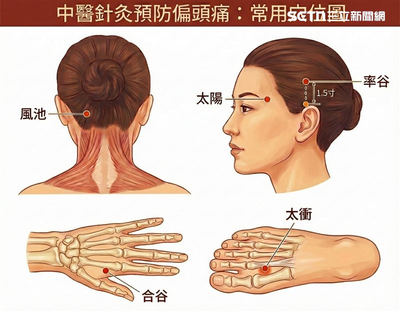中醫針灸預防頭痛常用穴位圖。（圖／周文程提供）