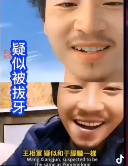 王相軍生前疑似被拔牙齒。（圖／翻攝自TikTok）