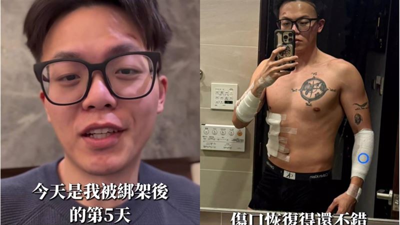 陳昊曝光傷勢。（圖／翻攝自IG＠traderch1599）