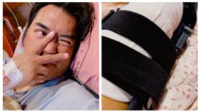 製作人B2（陳彥銘）膝蓋開刀。（圖／本人提供）