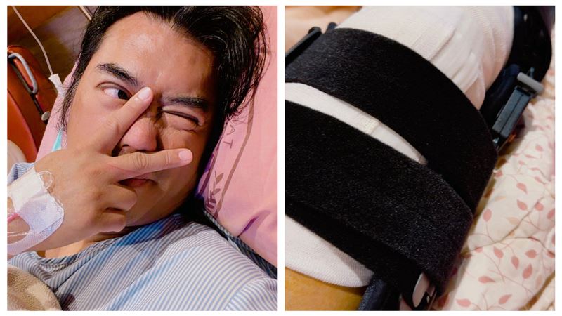 獨／B2突開刀做異體移植重建手術　病況曝