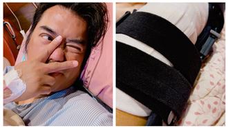 製作人B2（陳彥銘）膝蓋開刀。（圖／本人提供）