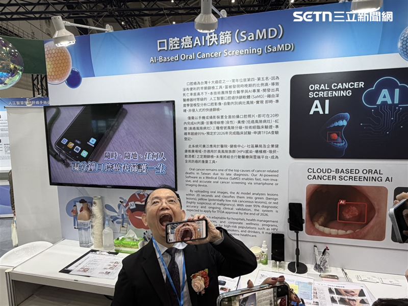 台大醫院與台大合作耗時6年研發「口腔癌AI快篩」,以手機鏡頭拍攝黏膜影像,最快20秒即能標定高風險病灶。(圖/記者簡浩正攝影)