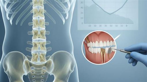 骨鬆患者拔、植牙當心！醫師帶你看懂治療