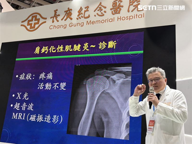 周文毅提醒民眾，若出現持續肩痛、夜間疼痛或手臂活動受限，應及早就醫診斷與治療。（圖／記者簡浩正攝影）