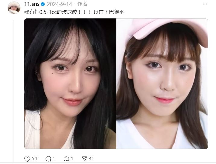 蕭伊不諱言有整形，強調「要說我整形臉啥的都沒差，我很樂意跟大家分享經驗，也歡迎跟我討論。」（圖／翻攝自蕭伊Threads）