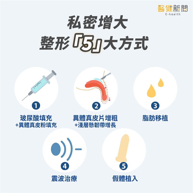 私密增大整型五大方式，以下為大家一一解析。（圖／醫健新聞網提供）