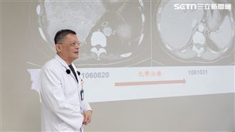 陽明交大醫院,宜蘭,台北,腫瘤,肝癌,肝臟,癌症（圖／陽明交大醫院提供）
