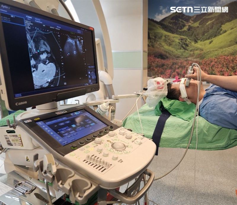 挪動超音波探頭，電腦斷層影像就會與超音波影像「同步性」地變化。（圖／許一智提供）