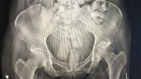 為高薪誘惑，當空中飛人，2泰籍女吞海洛因，肛門塞毒，搭機，落地被逮(圖／翻攝畫面)