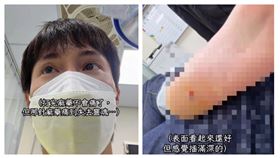 阿本（翁瑞迪）出外景遭尖石刺入腳後跟，急診清創打麻藥「痛到失去靈魂」（圖／翻攝自「阿本本人」臉書）