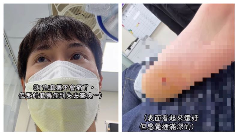遭尖石刺入腳跟 男星挨針:痛到失去靈魂