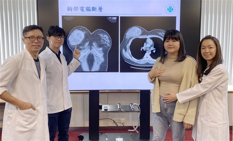 陳小姐在切除乳房手術後,意外發現懷孕,決定在醫療團隊協助下重建義乳。(圖/台中榮總醫院提供)