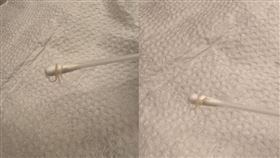 女兒狂喊屁股癢！母擦藥驚見肛門蟯蟲蠕動(圖/翻攝THREADS)