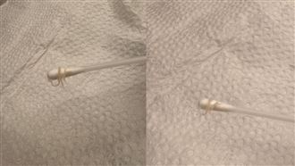 女兒狂喊屁股癢！母擦藥驚見肛門蟯蟲蠕動