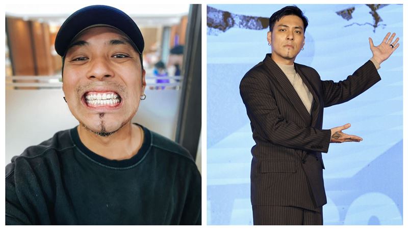 男星昔沒錢裝假牙　居酒屋打工揭真實近況