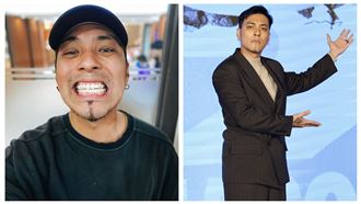 男星昔沒錢裝假牙　居酒屋打工揭真實近況