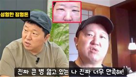鄭亨敦在節目中坦承自己去做眼下脂肪重新分布手術。（圖／翻攝自YT @mungchintv）