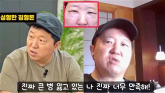韓大咖諧星認了整形　術後像被暴打慘照曝