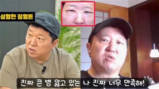 韓大咖諧星認了整形　術後像被暴打慘照曝