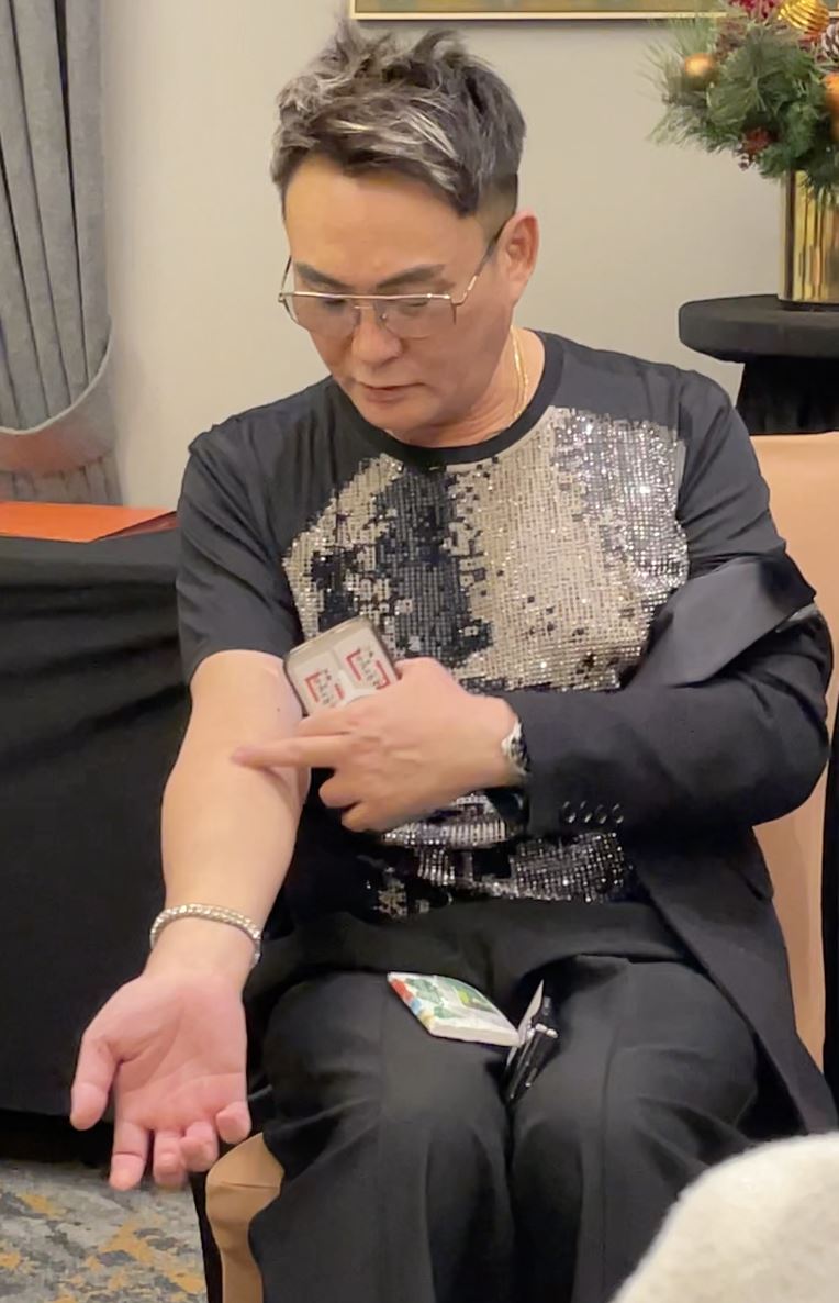 洪毛展示手上的針孔。(圖/記者趙浩雲攝影)