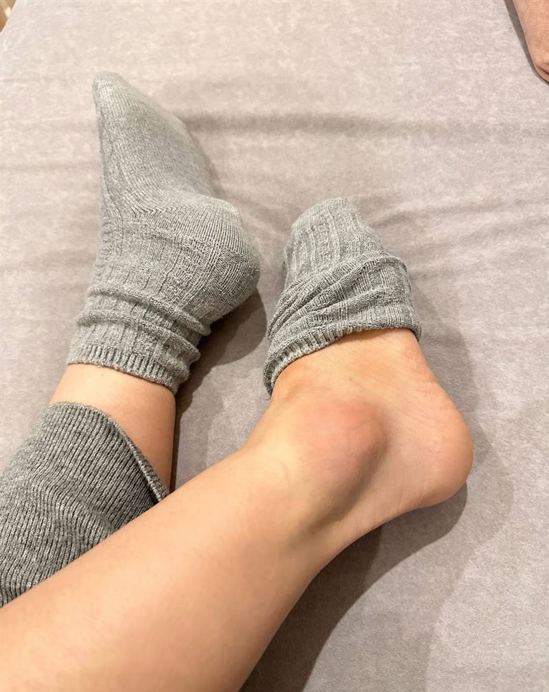 Apple扭傷腳踝。(圖/翻攝自Apple IG)