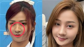 左圖為二月拍廣告畫面，右圖為小紫術後照片。（圖／樂天桃猿提供） 