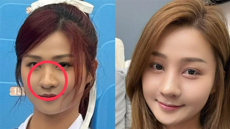 樂天女孩突開刀 醫:內部受傷嚴重